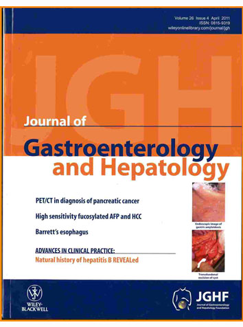 Riset HOCl membunuh Virus Hepatitis B Journal of Gastroenterology and Hepatology